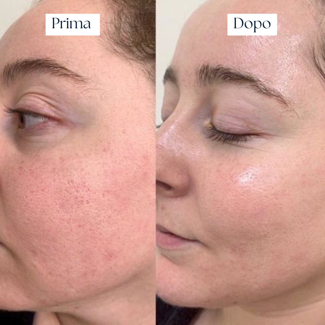 Crema Idratante Rigenerante – Nairé Moisturizing Cream