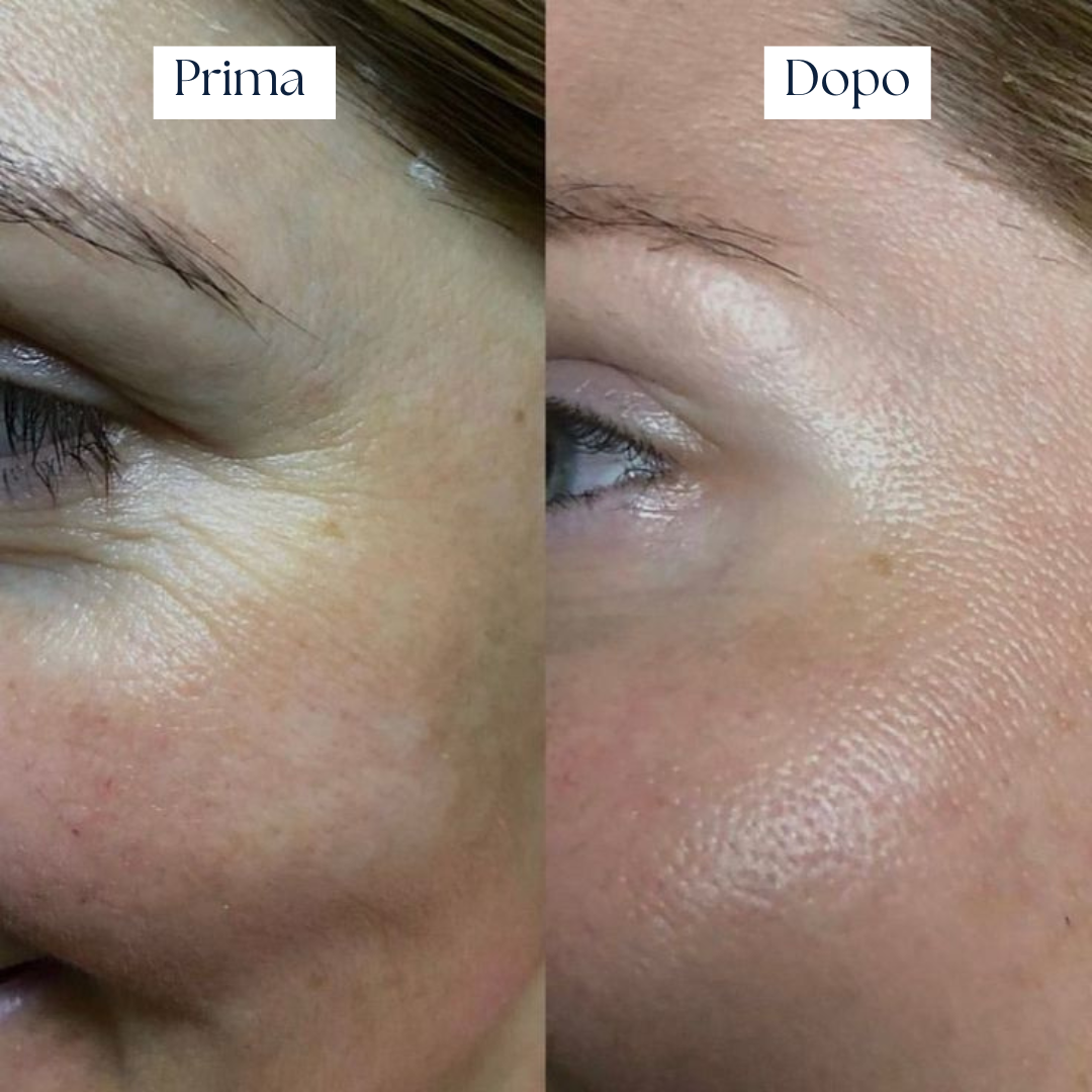 Crema Idratante Rigenerante – Nairé Moisturizing Cream