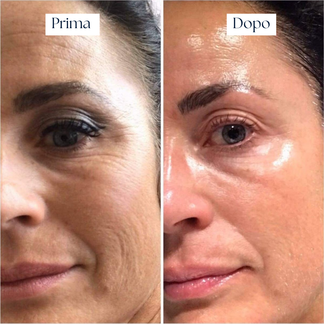 Crema Idratante Rigenerante – Nairé Moisturizing Cream