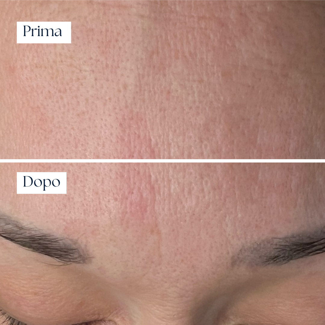 Crema Idratante Rigenerante – Nairé Moisturizing Cream