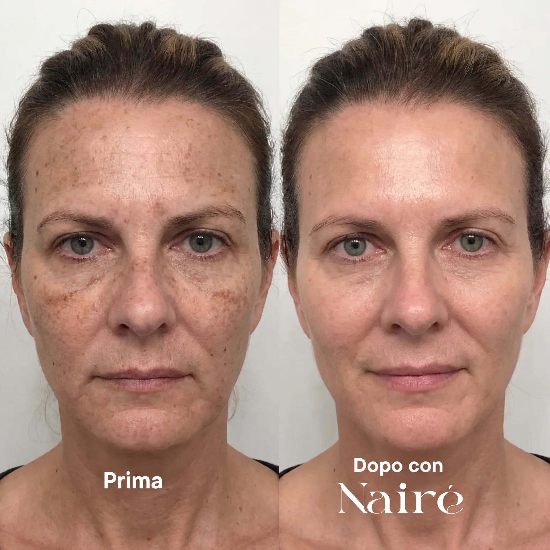 SUMMER SKIN RESET – TRATTAMENTO COMPLETO NAIRÉ®