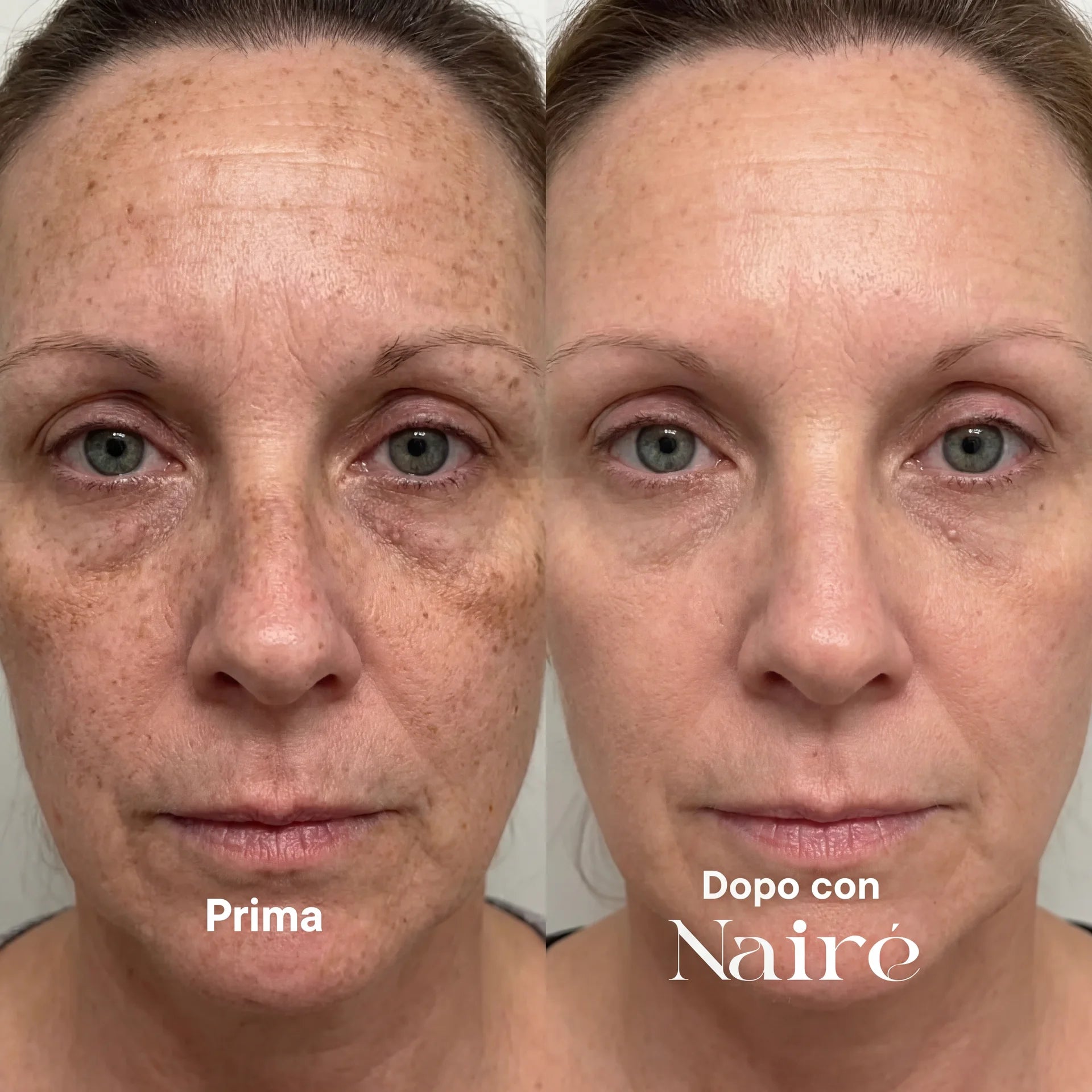SUMMER SKIN RESET – TRATTAMENTO COMPLETO NAIRÉ®